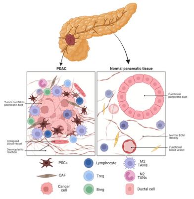 Innate and adaptive immune-directed tumour microenvironment in pancreatic ductal adenocarcinoma